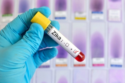 10% din femeile infectate cu Zika au născut un copil cu o malformaţie