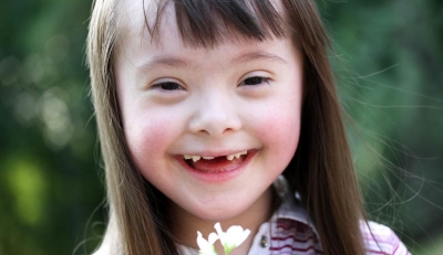Copiii diagnosticaţi cu sindromul Down vor beneficia de însoţitor