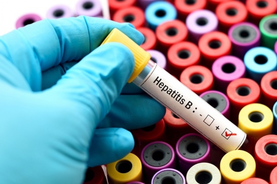 Doar 10% dintre românii cu hepatită B sunt diagnosticaţi