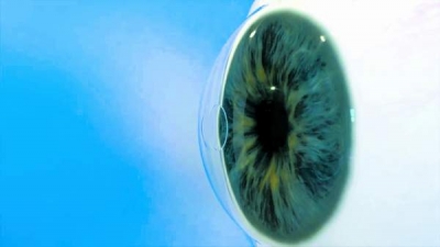 Un implant ocular minuscul ar putea elimina nevoia de a purta ochelari pentru lectură