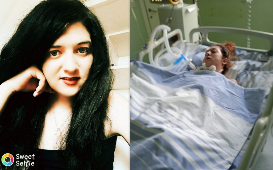 O tânără româncă de 26 de ani suferă de porfirie ("boala vampirului")
