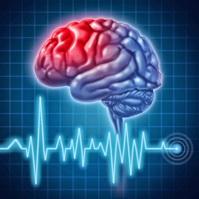 O nouă metodă de recuperare pentru victimele accidentelor vasculare cerebrale