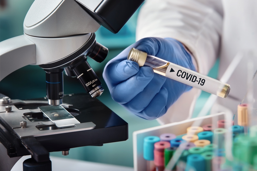 Studiu: Pacienţii COVID-19 din mai aveau o încărcătură virală mică faţă de cei din aprilie