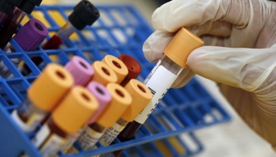 Un nou test de sânge poate depista tuberculoza în doar câteva ore