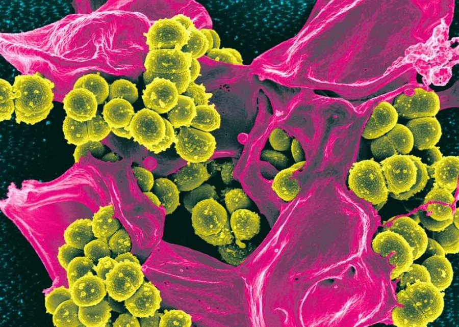 Noi speranţe în tratarea bolilor cauzate de „super-bacterii”