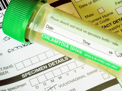Chlamydia este cea mai comună infecţie cu transmitere sexuală din Europa
