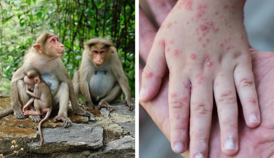 Alertă în Europa! Creşte numărul cazurilor de infectare cu „variola maimuţelor”
