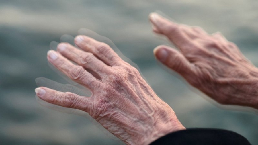 Apendicectomia ar reduce cu circa 20% riscul de a dezvolta boala Parkinson