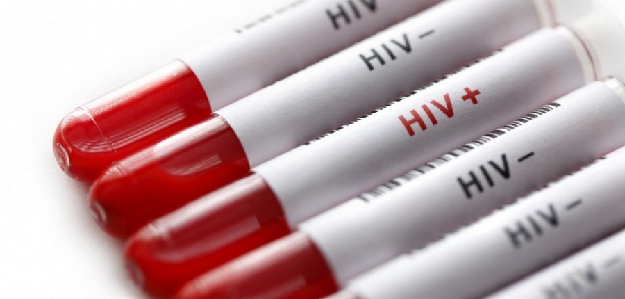 Infectările cu HIV în Europa, adesea detectate prea târziu