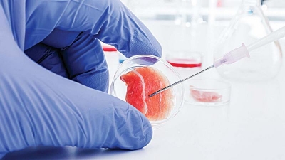 Punct de cotitură în lupta cu virusul HIV: A doua persoană din lume vindecată, după un transplant de celule stem