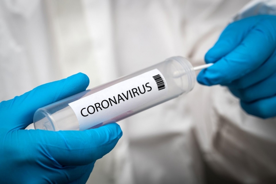 Coronavirus: Cercetătorii greci, aproape de a lansa un test propriu, mai ieftin, pentru detectarea COVID-19