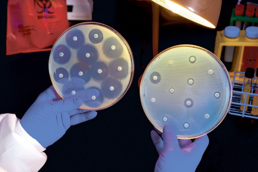 Bacteriile rezistente la antibiotice ar putea ucide 10 milioane de oameni pe an