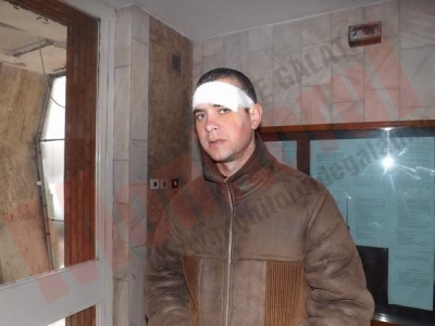 Un gălăţean acuză poliţiştii că l-au bătut ... din greşeală