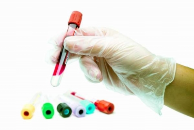 Un nou test sanguin pentru depistarea pacienţilor cu risc foarte scăzut de infarct