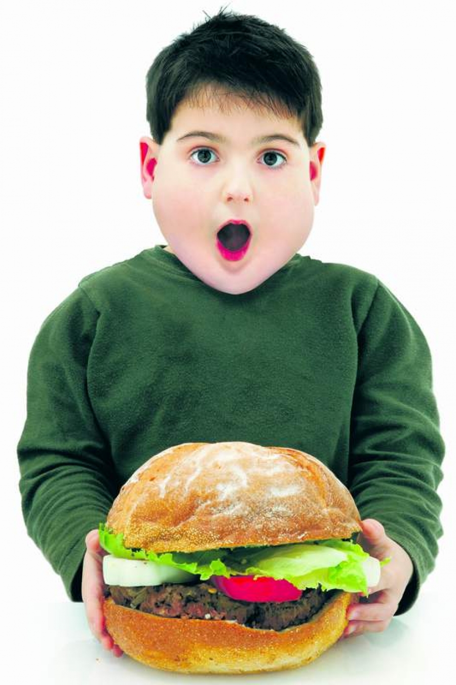 Obezitatea infantilă, "coşmar exploziv" în ţările în curs de dezvoltare