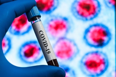 Coronavirusul circulă mai rapid decât în primăvară, avertizează un epidemiolog francez