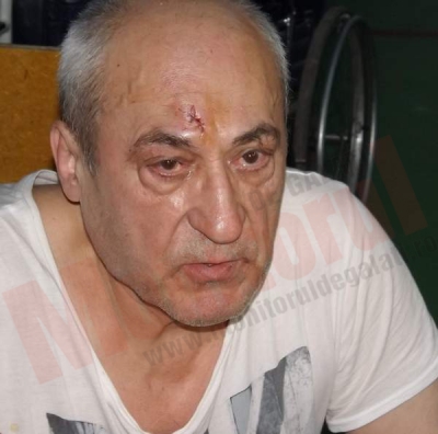 Medic agresat de un individ mascat, în curtea Judeţeanului