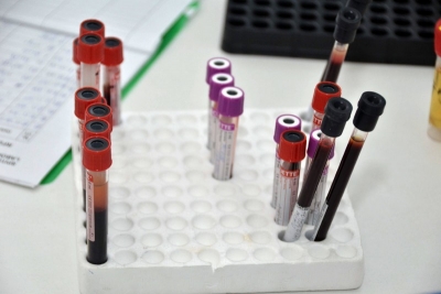 Prins băut la volan a refuzat prelevarea de mostre biologice