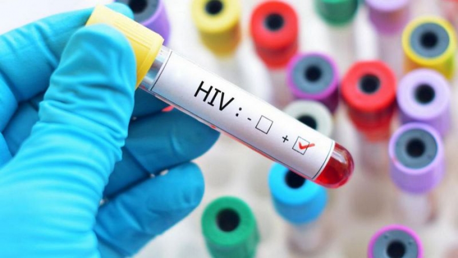 Un nou tratament anti-HIV, mai simplu, la fel de eficient ca terapiile clasice