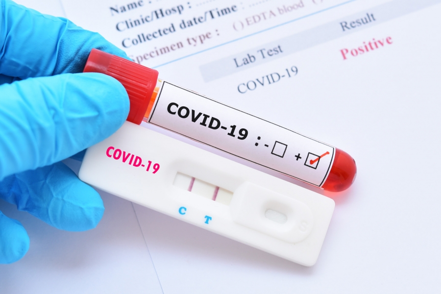 Coronavirus: Acord în cadrul UE pentru recunoaşterea reciprocă a testelor rapide