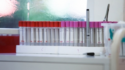 Prima licenţă acordată în Marea Britanie pentru crearea de embrioni umani folosind o tehnică IVF cu 3 părinţi