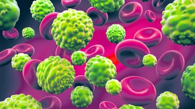 Descoperire a unei molecule care atacă melanoamele