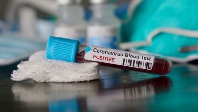 COVID-19: 3 noi decese şi alte 91 de infectări la Galaţi