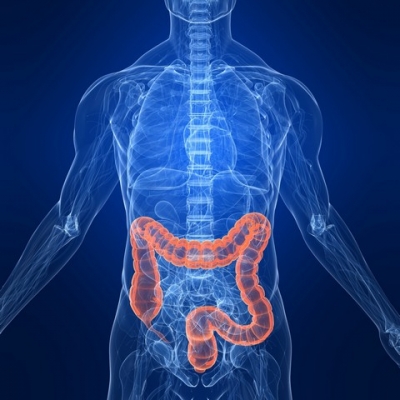 Numărul de cazuri de cancer de colon s-a triplat în ultimii 25 de ani