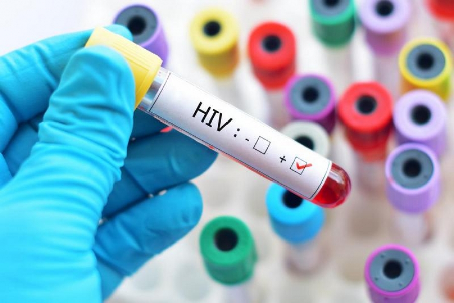 HIV, folosit în tratarea unei maladii severe