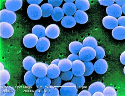 O super-bacterie rezistentă la antibiotice ar putea fi următoarea ameninţare pandemică