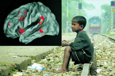 Se pare că sărăcia influenţează dezvoltarea cerebrală a copiilor