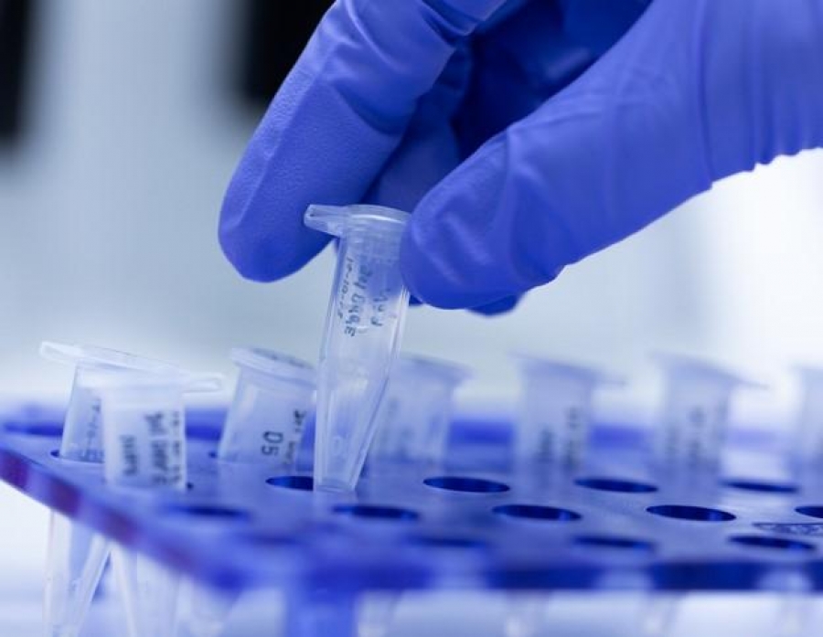 Cercetătorii australieni au inventat un test pentru coronavirus care oferă rezultatul în 20 de minute