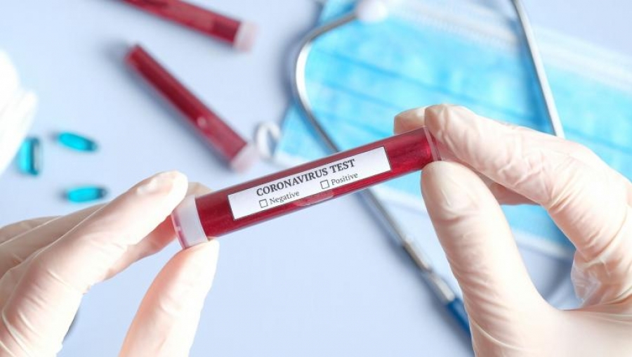 Coronavirus: Oamenii de ştiinţă ai Comisiei Europene propun un dispozitiv de control pentru verificarea fiabilităţii testelor