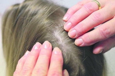132 de elevi cu păduchi şi râie, în şcolile gălăţene