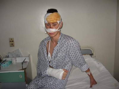 Bătut de nu l-au mai recunoscut nici agresorii