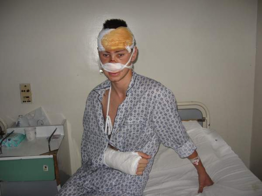 Bătut de nu l-au mai recunoscut nici agresorii