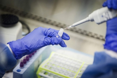 Un medicament pe bază de interferon beta ar reduce cu 79% riscul de a dezvolta o formă severă de COVID-19