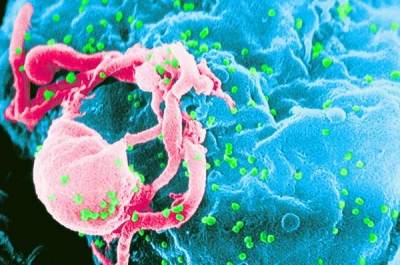 Peste 50% dintre persoanele nou diagnosticate cu HIV/SIDA au între 15 şi 29 de ani
