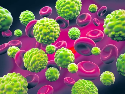 Majoritatea cazurilor de cancer, produse de stilul de viațã greșit