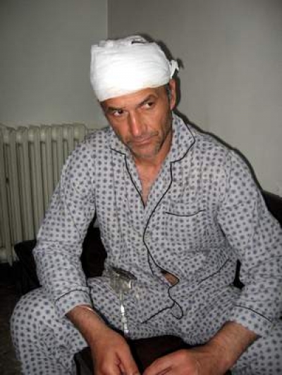 Bătut până a uitat cum îl cheamă