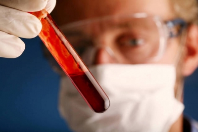 O nouă metodă de detecţie a cancerului hepatic