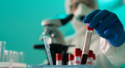 Studiu: Anticorpii produşi la contactul cu noul coronavirus nu s-ar menţine în corp mai mult de câteva luni