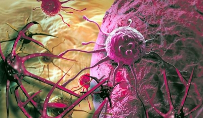Celulele canceroase ar putea fi distruse în fluxul sanguin cu ajutorul a două proteine ataşate de leucocite