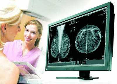 6.000 de românce au fost diagnosticate în 2011 cu cancer mamar