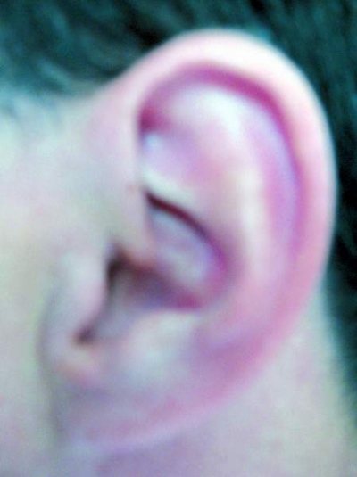 Lobii urechilor trădează vârsta