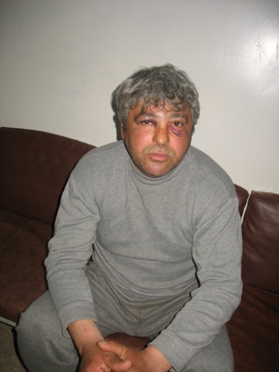 Tâlhărit de trei raţe în cartierul ţigănesc din Iveşti