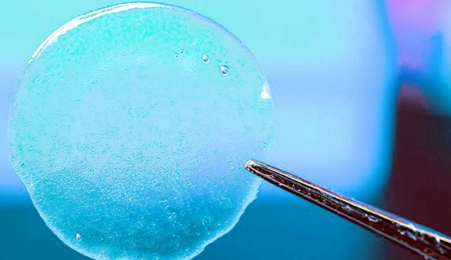 Un mic dispozitiv implantabil ar putea transforma tratamentul cancerului pancreatic