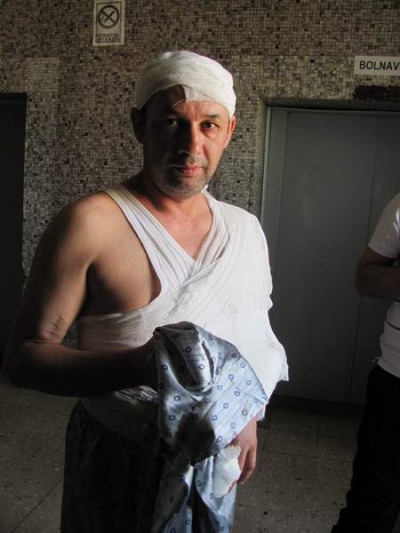 Şi-a alungat concubina şi a ajuns pe jumătate în ghips