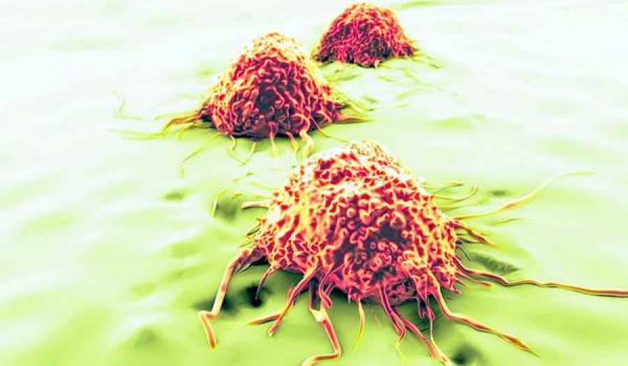 Oamenii de ştiinţă au aflat modul în care se răspândeşte cancerul
